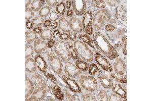 Immunohistochemical staining of human kidney with SLC25A26 polyclonal antibody  shows strong granular cytoplasmic positivity in tubular cells.