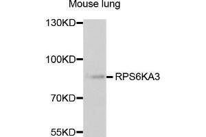 Western blot analysis of extracts of mouse lung, using RPS6KA3 antibody (ABIN5973157) at 1/1000 dilution.