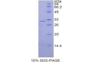 SDS-PAGE analysis of Human Septin 5 Protein. (Septin 5 Protein (SEPT5))