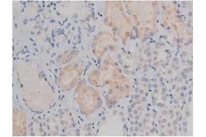 Immunohistochemistry (IHC) image for anti-FYN Oncogene Related To SRC, FGR, YES (FYN) (pTyr530) antibody (ABIN6256757)