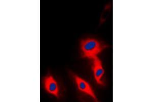Immunofluorescent analysis of Ephrin A5 staining in Hela cells. (Ephrin A5 antibody  (Center))
