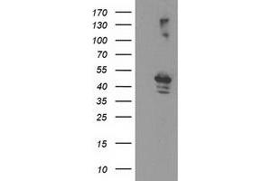 Western Blotting (WB) image for anti-Eukaryotic Translation Initiation Factor 2B, Subunit 3 Gamma, 58kDa (EIF2B3) antibody (ABIN1497967) (EIF2B3 antibody)