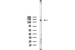 anti-5-Azacytidine Induced 1 (AZI1) (C-Term) antibody