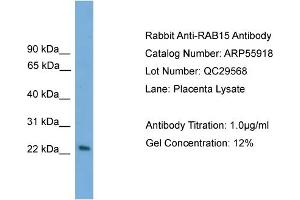 WB Suggested Anti-RAB15  Antibody Titration: 0. (RAB15 antibody  (Middle Region))