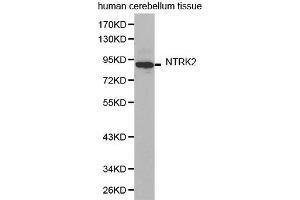 Western Blotting (WB) image for anti-Neurotrophic Tyrosine Kinase, Receptor, Type 2 (NTRK2) (AA 32-282) antibody (ABIN3022912) (TRKB antibody  (AA 32-282))
