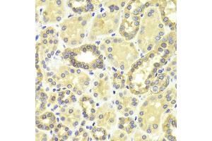 Immunohistochemistry of paraffin-embedded human kidney using MAP2K2 antibody. (MEK2 antibody)
