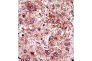 Image no. 2 for anti-Cyclin G Associated Kinase (GAK) (N-Term) antibody (ABIN360520) (GAK antibody  (N-Term))