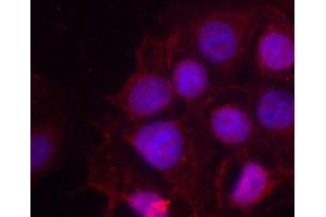 Immunofluorescence staining of methanol-fixed MCF cells using Phospho-ESR1-S118 antibody.