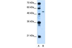 Image no. 1 for anti-Pregnancy Specific beta-1-Glycoprotein 1 (PSG1) (AA 96-145) antibody (ABIN204992)