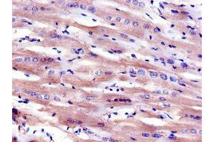 Immunohistochemistry of paraffin-embedded human heart tissue using ABIN7158887 at dilution of 1:100 (Macrophage Scavenger Receptor 1 antibody  (AA 271-446))