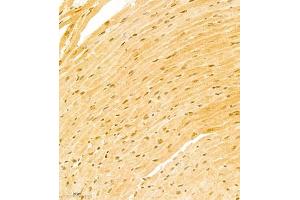 Immunohistochemistry of paraffin embedded mouse heart using ATF7 (ABIN7072916) at dilution of 1:800 (300x lens) (ATF7 antibody)