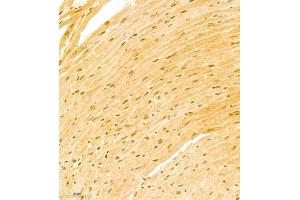 Immunohistochemistry of paraffin embedded mouse heart using ATF7 (ABIN7072916) at dilution of 1:800 (300x lens) (AFT7 antibody)