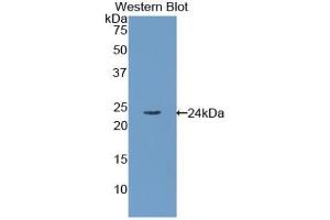 Detection of Recombinant RBP4, Human using Polyclonal Antibody to Retinol Binding Protein 4 (RBP4) (RBP4 antibody)