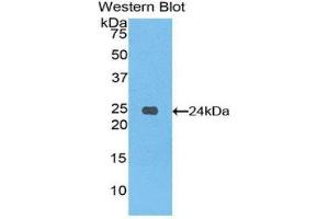 Western Blotting (WB) image for anti-Spondin 1 (SPON1) (AA 608-802) antibody (ABIN1860615) (SPON1 antibody  (AA 608-802))