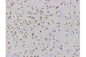 ABIN7094994 and ABIN7099050 at 1/100 staining rat brain tissue by IHC-P.