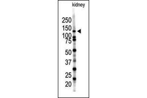 Western blot analysis of SENP7 polyclonal antibody (ABIN388053 and ABIN2845652) in mouse kidney tissue lysate (35 μg/lane).