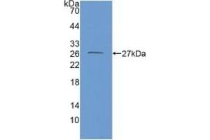 Detection of Recombinant GDH, Mouse using Polyclonal Antibody to Glutamate Dehydrogenase 1 (GLUD1) (GLUD1 antibody  (AA 65-273))