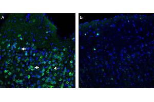 Expression of Orai1 in rat parietal cortex. (ORAI1 antibody  (2nd Extracellular Loop))