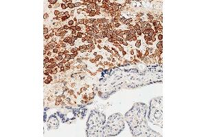 Immunohistochemical analysis of paraffin-embedded Human placenta tissue using (ABIN652888 and ABIN2842575) performed on the Leica® BOND RXm. (HLAG antibody  (AA 62-89))
