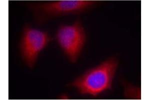 Image no. 2 for anti-Protein Kinase C, theta (PRKCQ) (AA 674-678) antibody (ABIN197567) (PKC theta antibody  (AA 674-678))