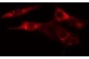 ABIN6277566 staining HeLa cells by IF/ICC. (EEF2K antibody  (Internal Region))