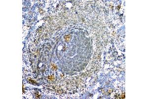 IHC analysis of ARA9/AIP using anti-ARA9/AIP antibody (ABIN6719423). (AIP antibody  (AA 91-330))