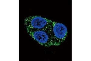 Confocal immunofluorescent analysis of Tyrosinase Antibody (C-term) Cat. (TYR antibody  (C-Term))