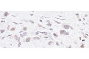 Immunohistochemistry (IHC) image for anti-Polymerase (RNA) III (DNA Directed) Polypeptide B (POLR3B) (AA 1083-1133) antibody (ABIN7453642) (POLR3B antibody  (AA 1083-1133))