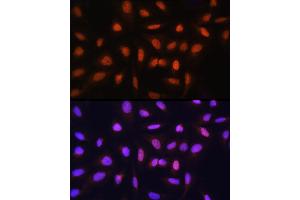 Immunofluorescence analysis of U-2 OS cells using GTF2H1 Rabbit pAb (ABIN6131728, ABIN6141498, ABIN6141499 and ABIN6222557) at dilution of 1:100 (40x lens). (GTF2H1 antibody  (AA 1-425))