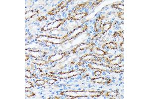 Immunohistochemistry (IHC) image for anti-Ribosomal Protein S6 Kinase, 70kDa, Polypeptide 2 (RPS6KB2) antibody (ABIN7270034)