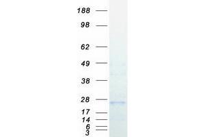 Western Blotting (WB) image for Integrin beta 3 Binding Protein (Beta3-Endonexin) (ITGB3BP) protein (Myc-DYKDDDDK Tag) (ABIN2713912)