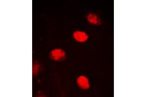 Immunofluorescent analysis of NPAS4 staining in HEK293T cells. (NPAS4 antibody  (C-Term))