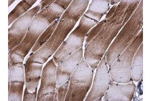 Immunohistochemistry (IHC) image for anti-HIV-1 Tat Interactive Protein 2, 30kDa (HTATIP2) antibody (ABIN2857073)