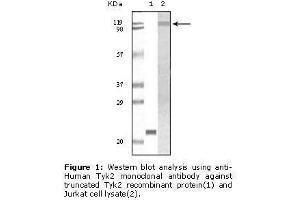 Image no. 1 for anti-Tyrosine Kinase 2 (TYK2) antibody (ABIN232114) (TYK2 antibody)