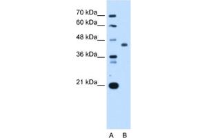Western Blotting (WB) image for anti-ST3 beta-Galactoside alpha-2,3-Sialyltransferase 4 (ST3GAL4) antibody (ABIN2462999) (ST3GAL4 antibody)