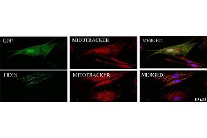 Human skin fibroblasts from healthy individuals were transduced with lentivirus carrying pH AGE-TID1S gene or vector control for 5 days prior to staining vector control with an anti-GFP antibody (cat. (GFP antibody  (AA 1-238))