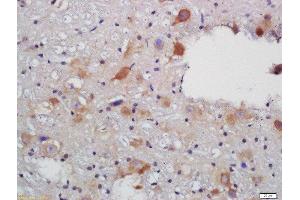 Formalin-fixed and paraffin embedded rat brain labeled with Rabbit Anti-VAT Polyclonal Antibody, Unconjugated (ABIN735113) at 1:200 followed by conjugation to the secondary antibody and DAB staining (SLC18A3 antibody  (AA 201-300))