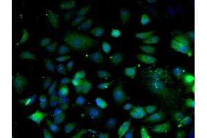 Image provided by One World Lab validation program. (Integrin Alpha3, Beta1 (AA 976-1025) antibody)