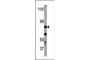 The anti-Phospho-IKKb- Pab (ABIN389574 and ABIN2839600) is used in Western blot to detect Phospho-IKKb- in Y79 tissue lysate (IKBKB antibody  (pTyr199))