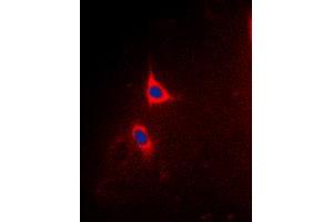 Immunofluorescent analysis of BCLX (pT47) staining in Hela cells. (BCL2L1 antibody  (pSer47))