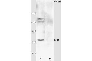 L1 rat brain lysates L2 rat kidney lysates probed with Anti IL-2R gamma/CD132 Polyclonal Antibody, Unconjugated (ABIN685432) at 1:200 overnight at 4 °C. (GADD45A antibody  (AA 65-165))