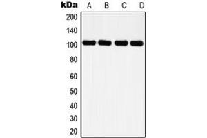 Western blot analysis of Histone Deacetylase 7 expression in HeLa (A), NIH3T3 (B), PC12 (C), rat kidney (D) whole cell lysates. (HDAC7 antibody  (C-Term))