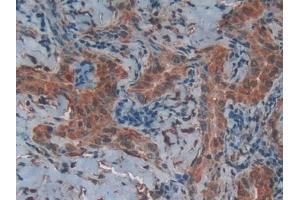 Used in DAB staining on fromalin fixed paraffin-embedded Liver tissue (CD40 Ligand antibody  (AA 180-261))
