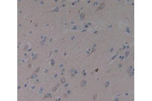 Used in DAB staining on fromalin fixed paraffin- embedded brain tissue (SMS antibody  (AA 2-366))