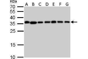 WB Image PPA1 antibody detects PPA1 protein by Western blot analysis. (Pyrophosphatase (Inorganic) 1 (PPA1) antibody)