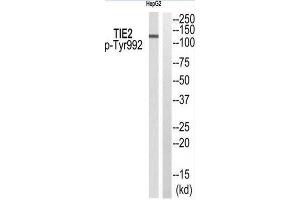 Western Blotting (WB) image for anti-TEK Tyrosine Kinase, Endothelial (TEK) (pTyr992) antibody (ABIN1847656) (TEK antibody  (pTyr992))