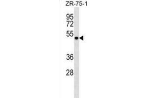 Western Blotting (WB) image for anti-DEAD (Asp-Glu-Ala-Asp) Box Polypeptide 6 (DDX6) antibody (ABIN2999135)