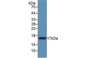 Detection of Recombinant MMP11, Mouse using Polyclonal Antibody to Matrix Metalloproteinase 11 (MMP11) (MMP11 antibody  (AA 287-491))