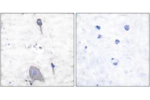 Immunohistochemistry analysis of paraffin-embedded human brain tissue, using Sirp alpha1 Antibody. (SIRPA antibody  (AA 451-500))