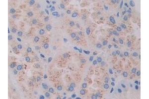 Immunohistochemistry (IHC) image for anti-Filamin C, gamma (FLNC) (AA 17-259) antibody (ABIN7441958)